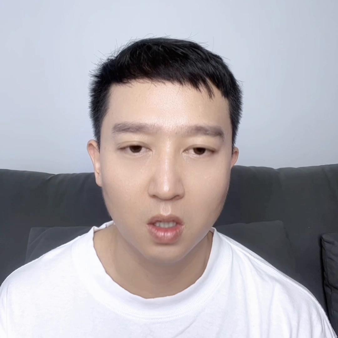 遗传秃头一般什么时候秃,秃头是遗传怎么治疗