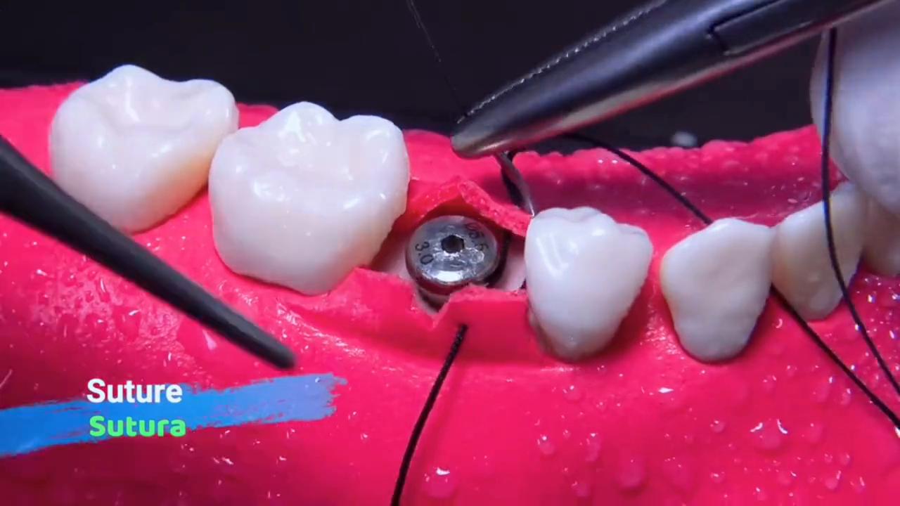 沉浸式牙处理,沉浸式弄牙齿