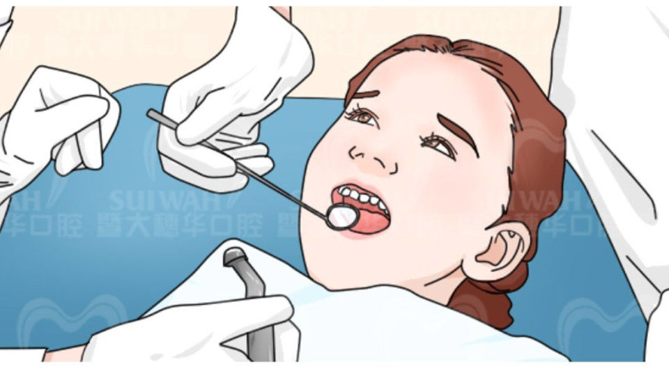 为什么蛀牙要补,为什么蛀牙不建议补门牙