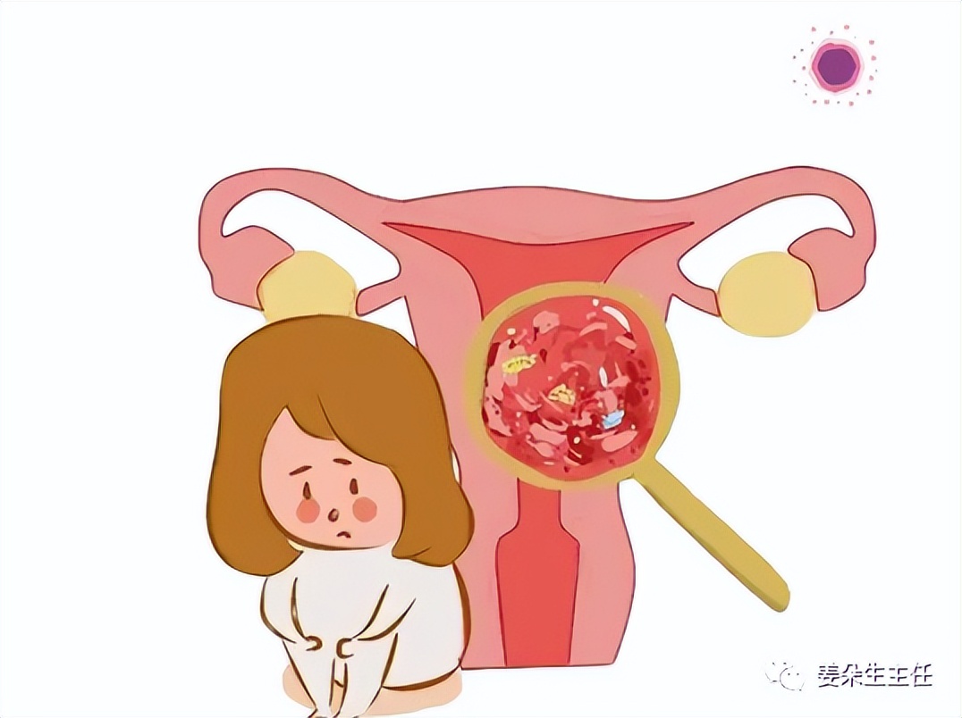 明明很爱干净为什么霉菌反反复复,明明很爱干净为什么还会得荨麻疹