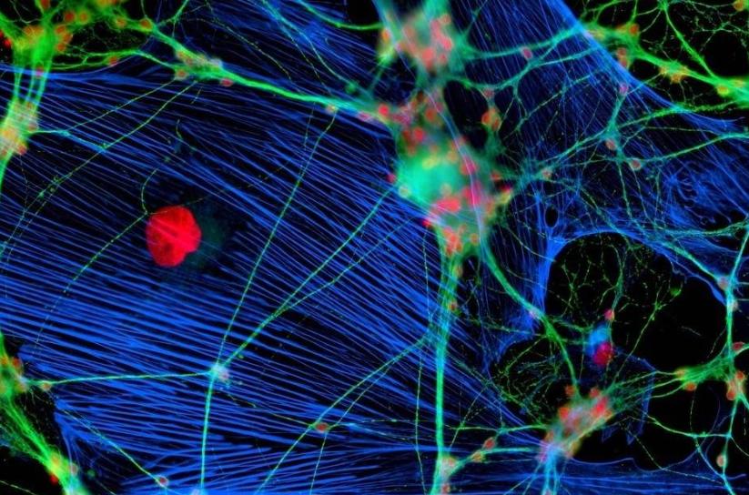 病理性神经疼吃什么药,病理性疼痛