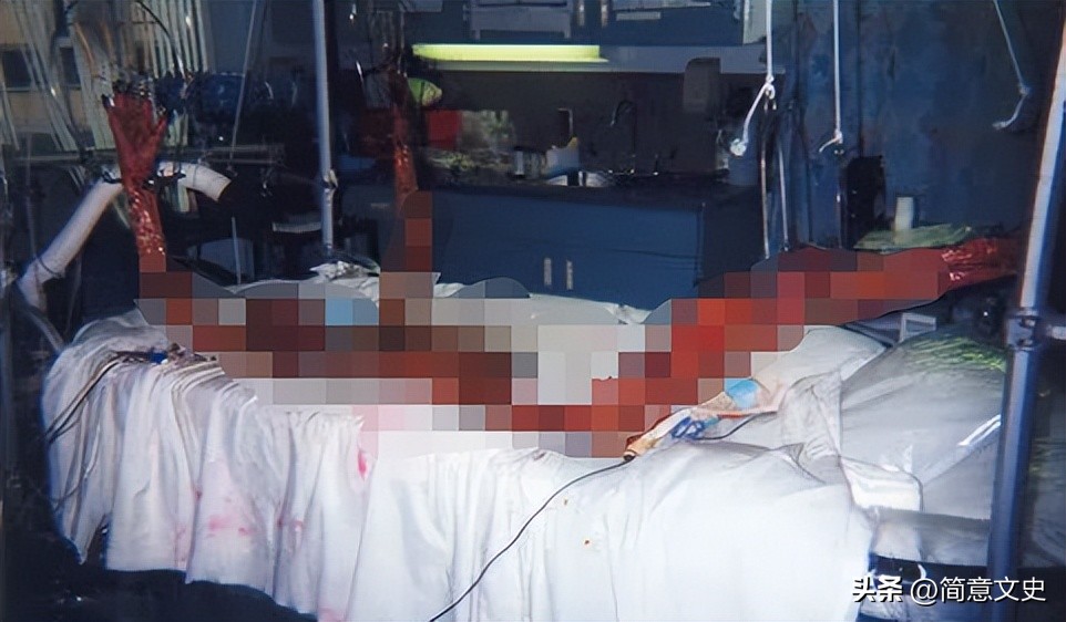 核辐射对人体的伤害的真实案例,核辐射真实案例