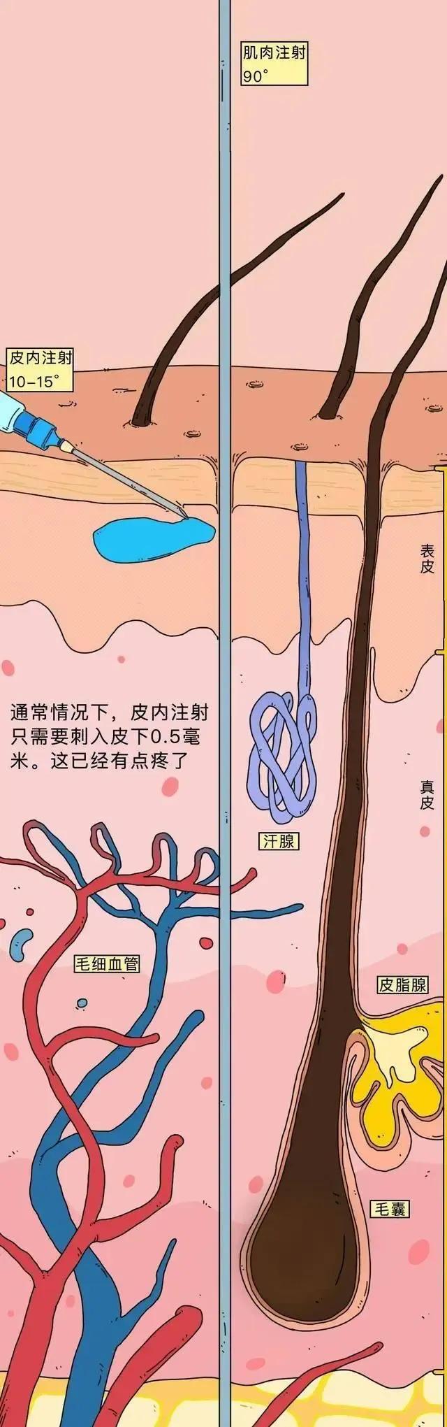 童年噩梦——“屁股针”，为啥那么痛？「漫画揭秘