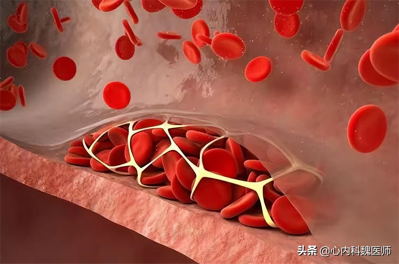 控制冠心病的药,治疗心血管疾病的药物哪个最好