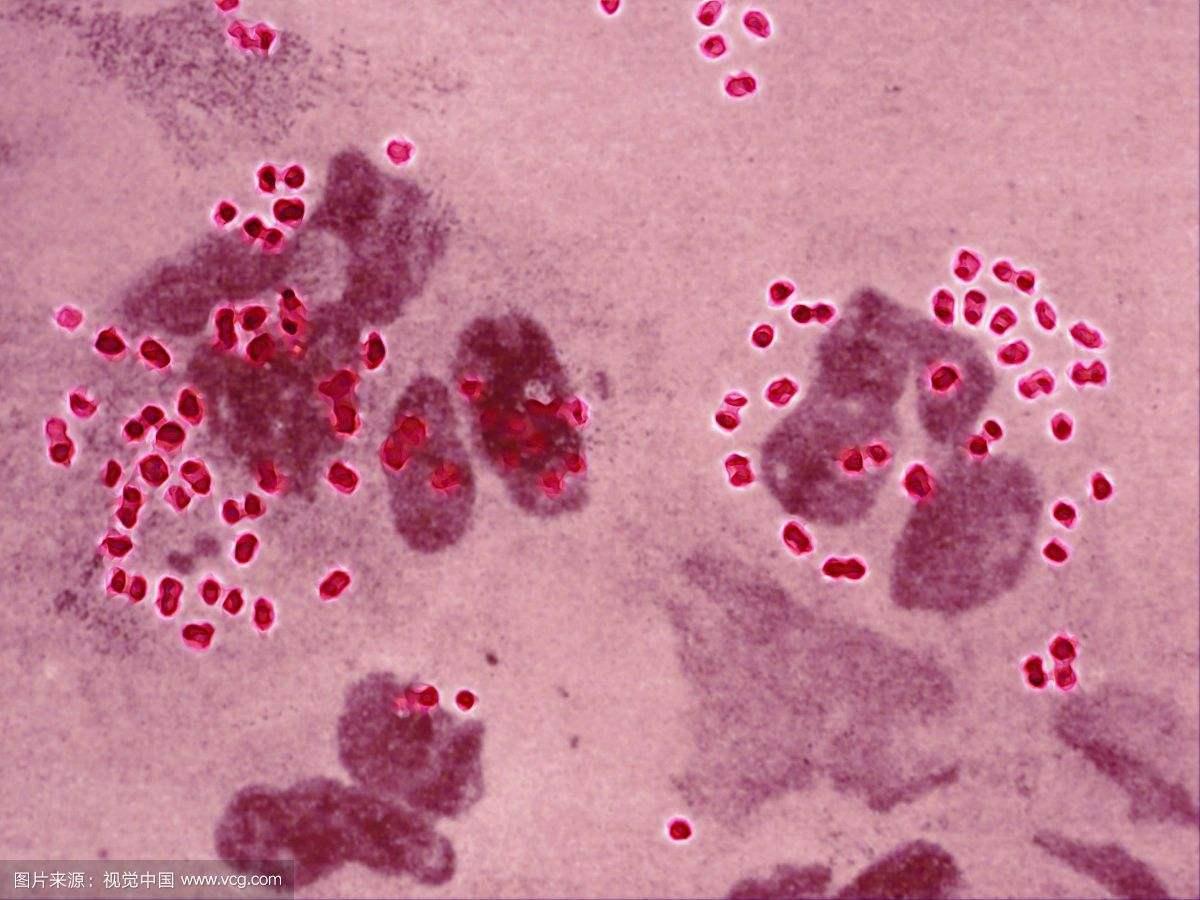 哪些疾病可以通过性传播,可以通过性传播的疾病