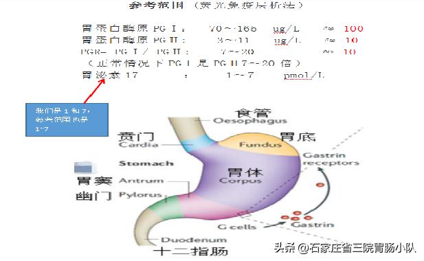 胃功能三项解读,胃功能三项全偏高