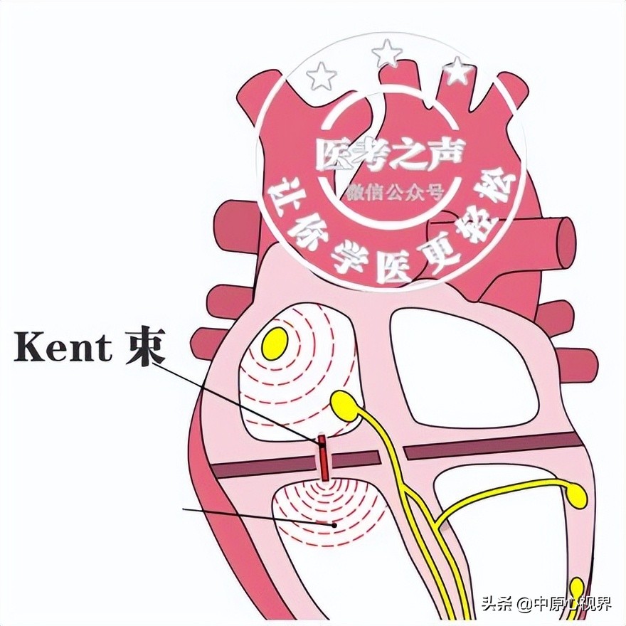 护考几种常见的心电图,常见的心电图图形分析