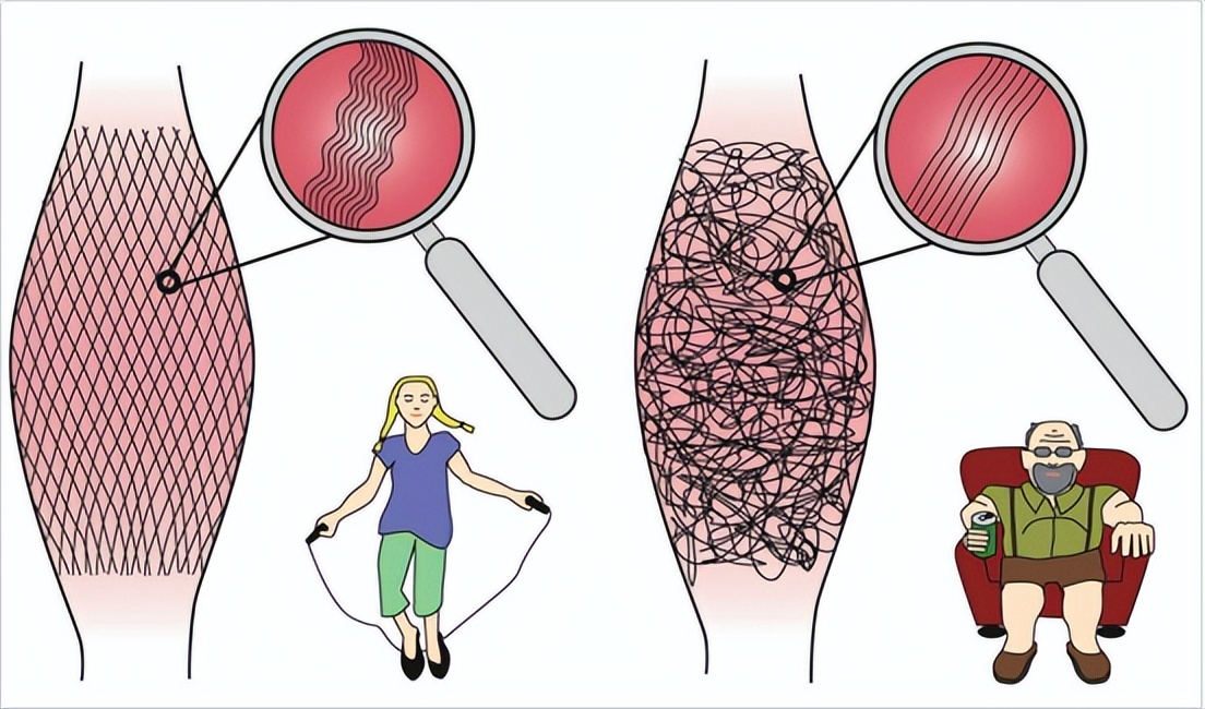 测评口碑最好的筋膜枪,测评筋膜枪热门