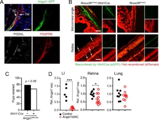 青光眼逆转,治疗青光眼临床新突破