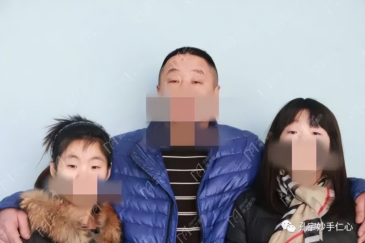 儿童上睑下垂怎么矫正,有什么方法可以帮助孩子上睑下垂