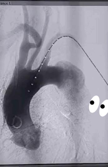 唐俊医生,介入治疗肿瘤唐医生