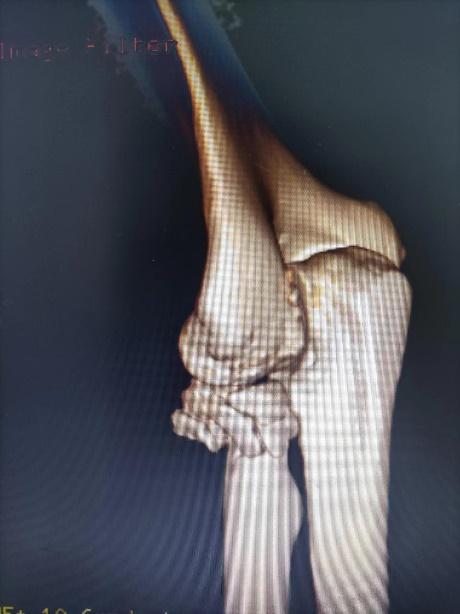 优秀!重庆两江新区中医院年度十佳技术出炉!