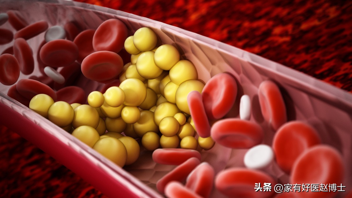 总胆固醇高，但低密度不高，要吃他汀吗？警惕这项“隐藏”指标！