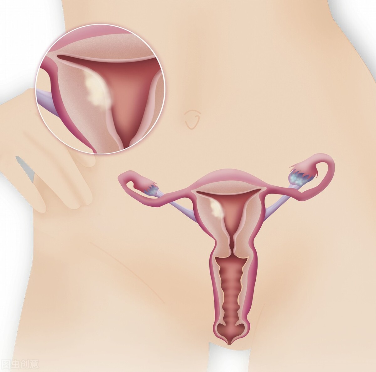 妇科检查可见少量dna倍体异常细胞,妇科检查b超的专业术语