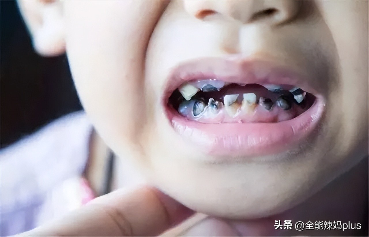 孩子换牙一般到几岁结束,换牙顺序表告诉你孩子换牙时间