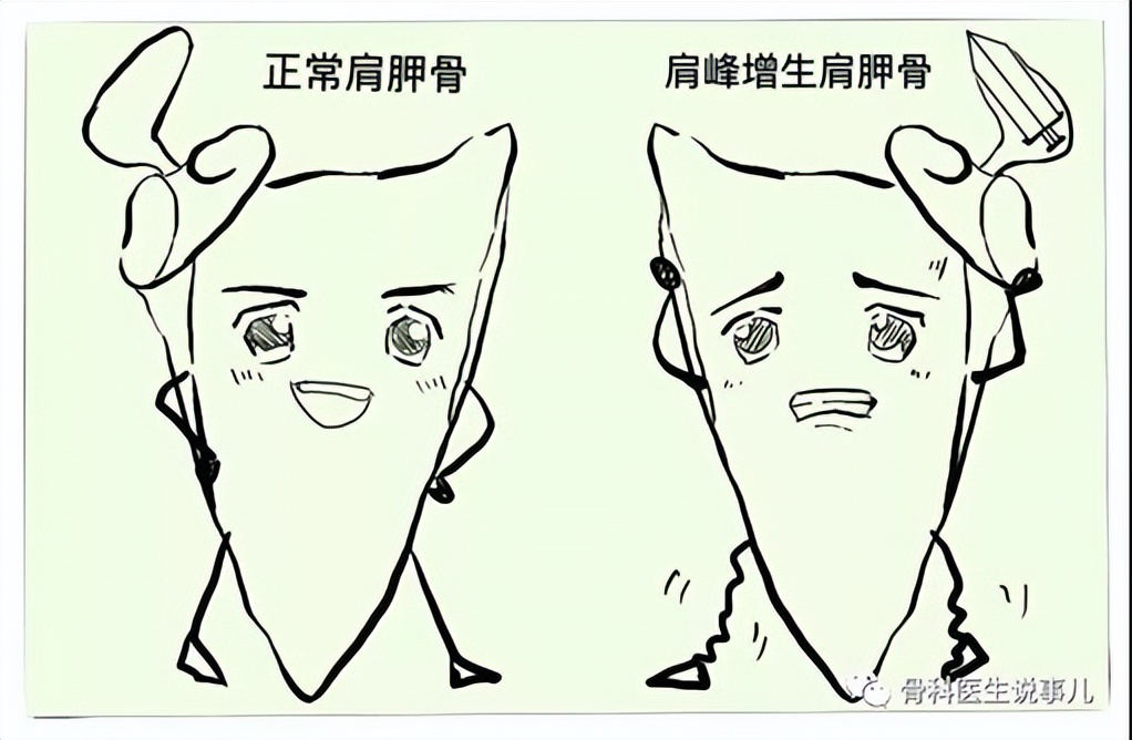 手臂抬举就酸胀是什么原因,手臂抬举肩膀就痛是什么原因