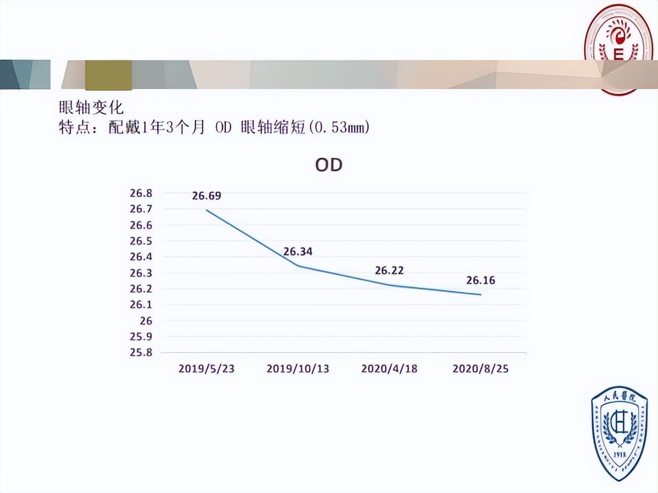 王凯角膜塑形镜原理,王凯医生塑形镜