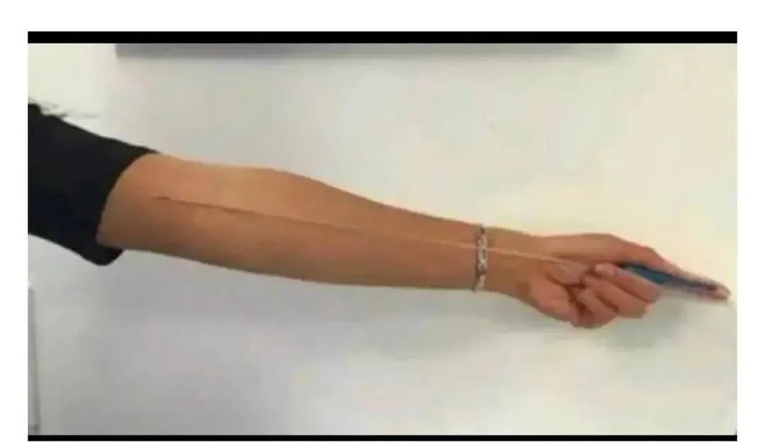 当取卵针戳进我的卵巢,丈夫在隔壁看片......