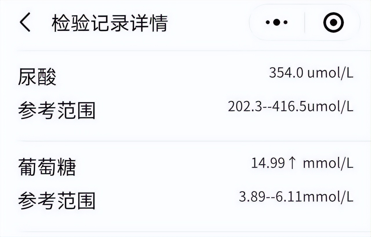 2型糖尿病伴血糖控制不佳诊断,儿童二型糖尿病血糖控制参照表