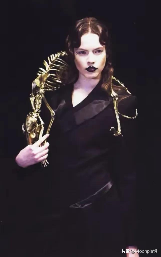 为什么胼胝体会缺失,schiaparelli水平