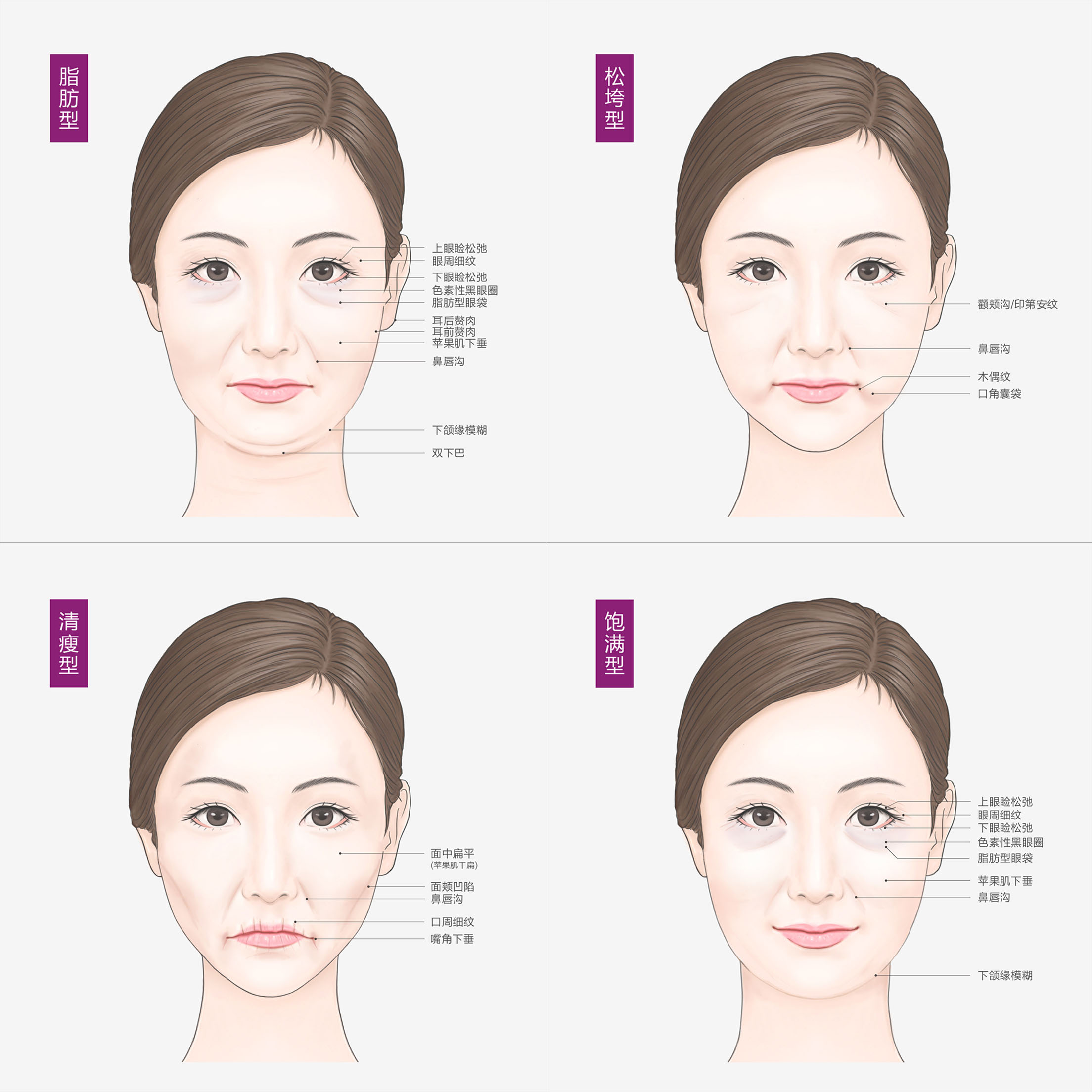 脸部凹陷还下垂松弛做全脸填充吗,脸部凹陷填充用什么填充最好