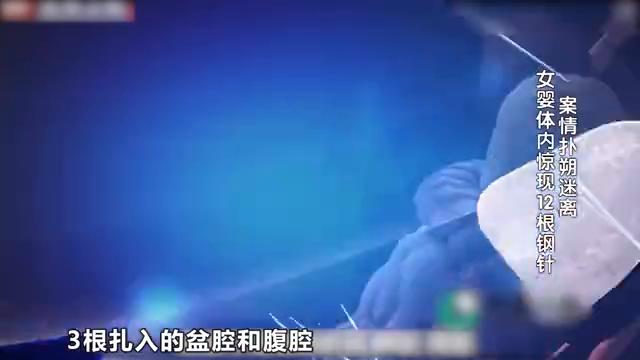 十月女婴体内被扎后续,十个月大女童被扎12根钉