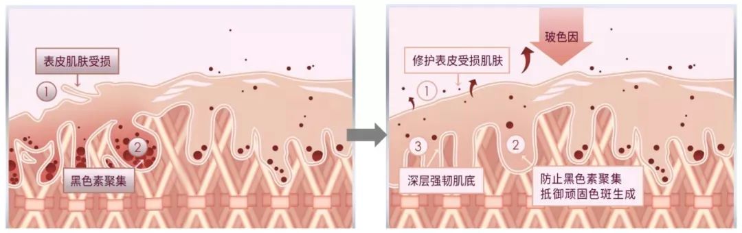 科颜氏美白淡斑精华去痘印,科颜氏美白淡斑精华液去痘印
