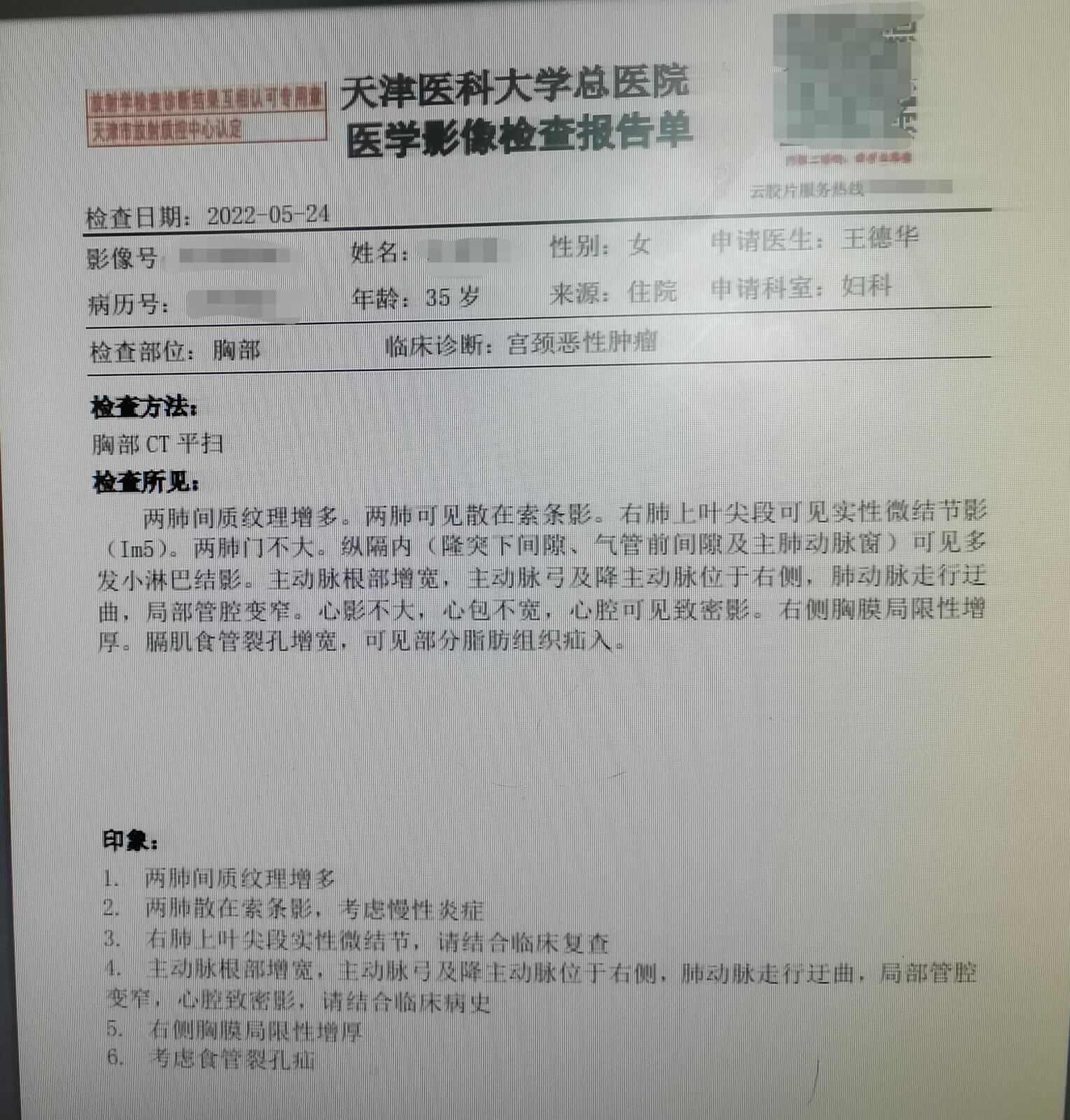 刘懿博士说肺癌晚期合并脑梗,刘懿博士肺癌治疗方法