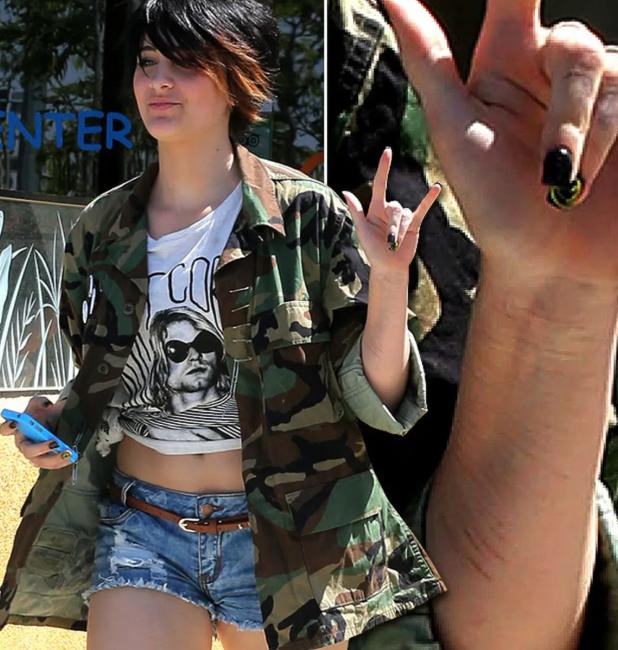 迈克尔杰克逊去世得了什么疾病,迈克杰克逊儿子遗传白化病