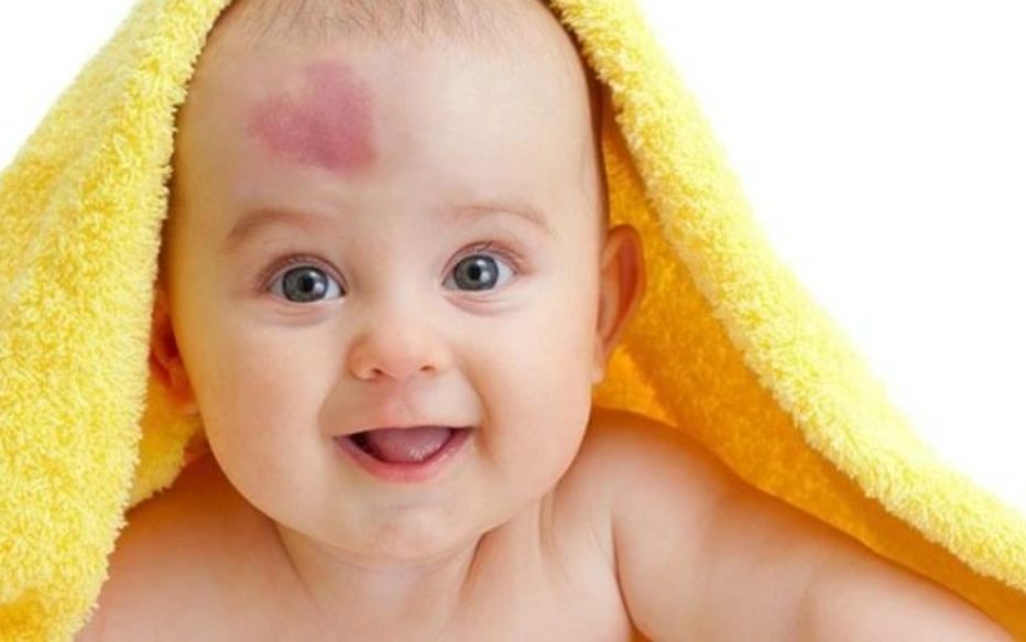 宝宝出生挺白为什么越长越黑,宝宝刚出生很白后面变黑红