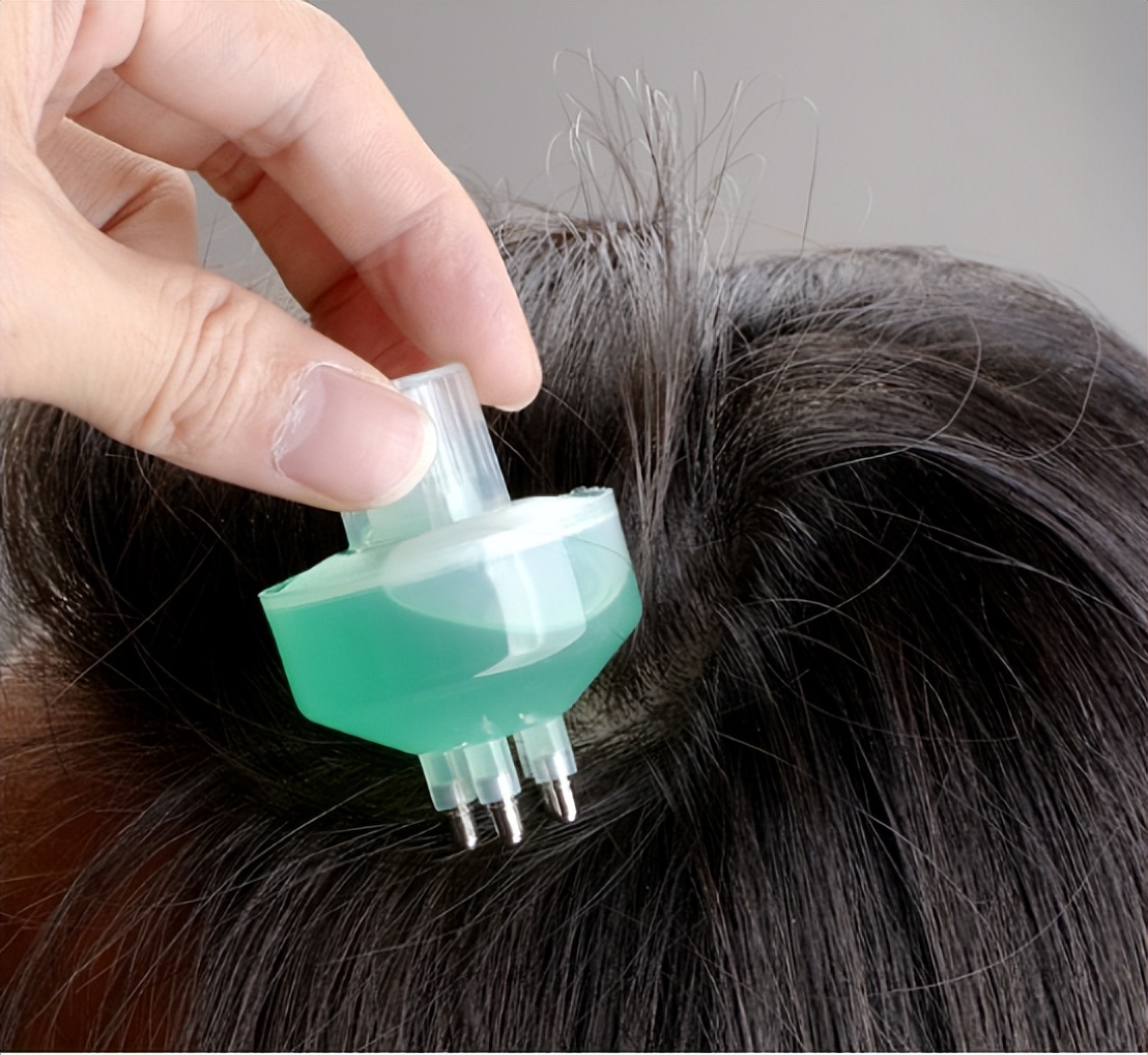 怎么让头发长得快一周内长5cm,怎样能让头发长得快一点儿