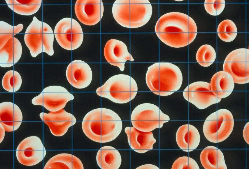 切胃减肥好不好有没有副作用,切胃减肥真的好吗