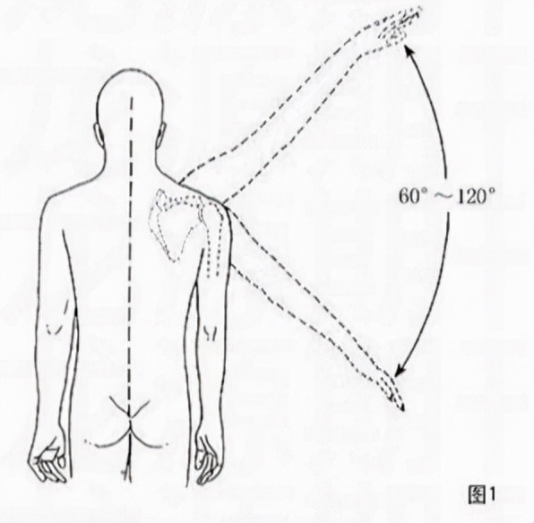 肩周炎是肩痛但肩痛并非肩周炎,肩周炎来袭这4个小动作缓解肩痛