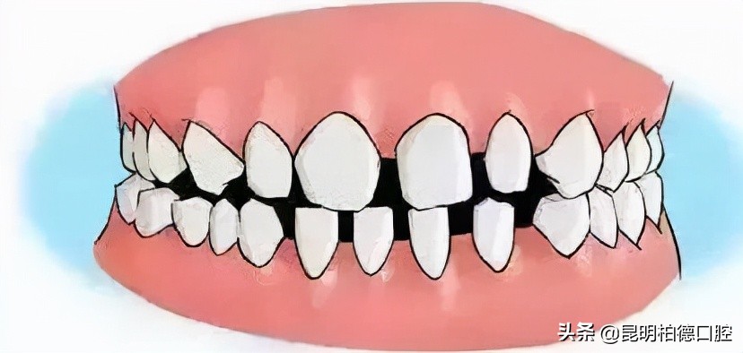 牙齿那些事,有关牙齿那些事儿
