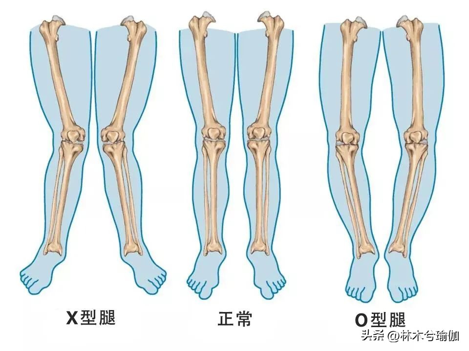 加强内收肌能改善o型腿吗,练内收肌可以瘦腿吗
