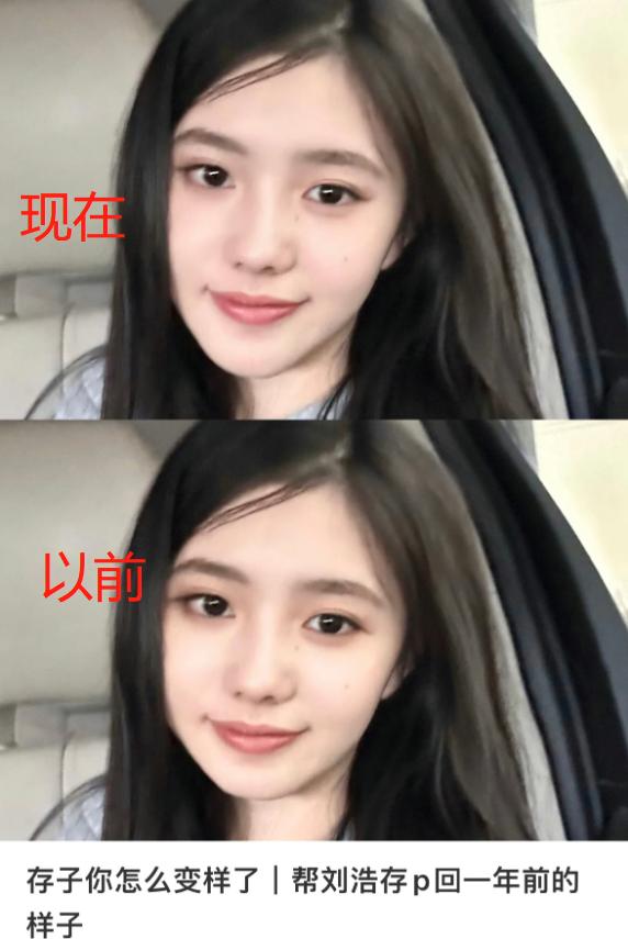 整容失败的女星蛇精脸,女星整容失败脸歪嘴斜