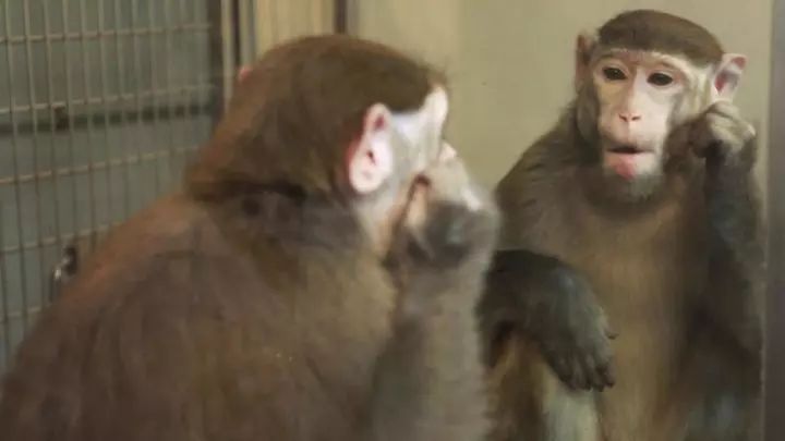 幻肢、恋足是心理出现问题吗？这些行为的背后大脑都有解释