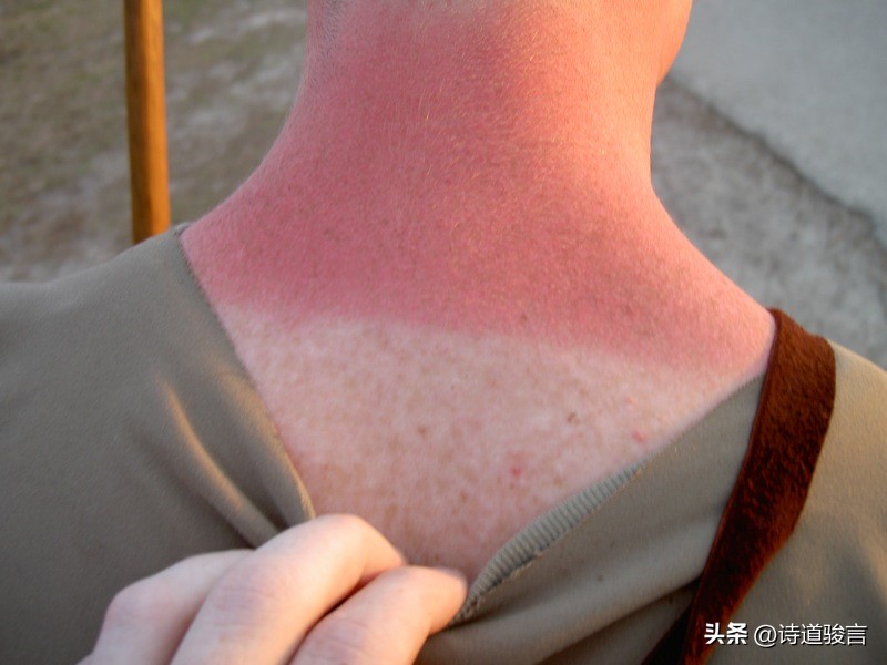 美国红脖子什么意思,美国红脖子