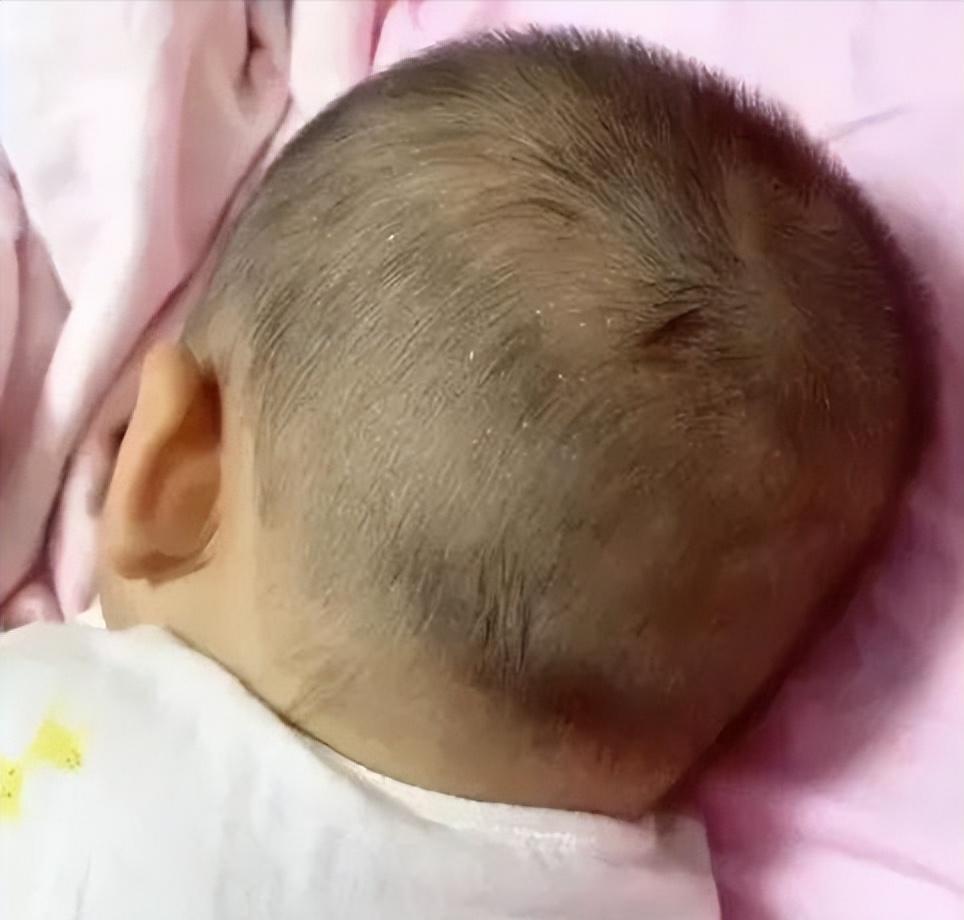 宝宝睡觉出汗的原因和解决方法,一睡就热出汗是什么原因