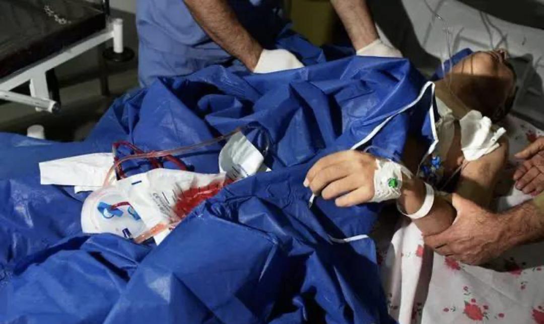 为了不饿死，伊朗人正在卖掉*丸睾**