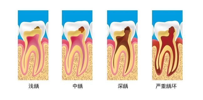 小洞不补大洞吃苦的意思,小洞不补大洞吃苦的道理