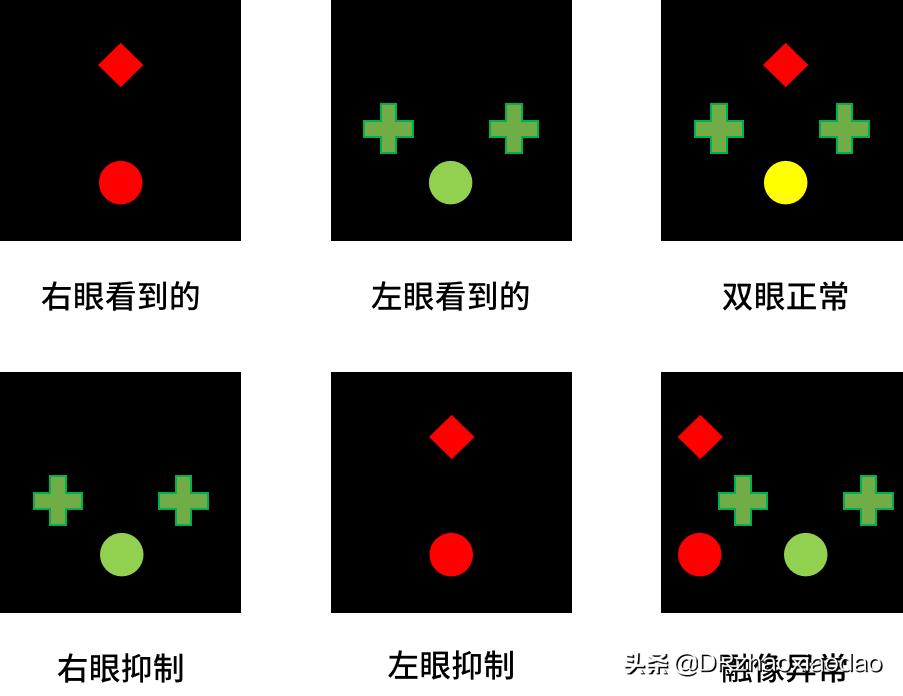 视功能和调节力报告解读