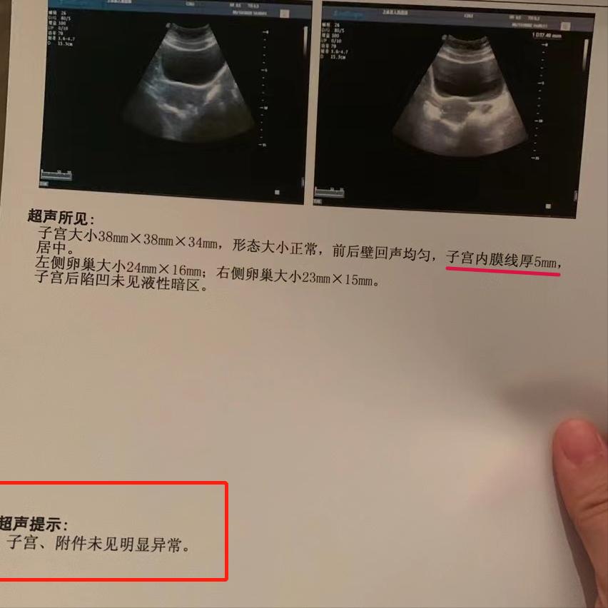 月经刚完又有痛经的感觉又出血,撤退性出血肚子痛跟痛经一样