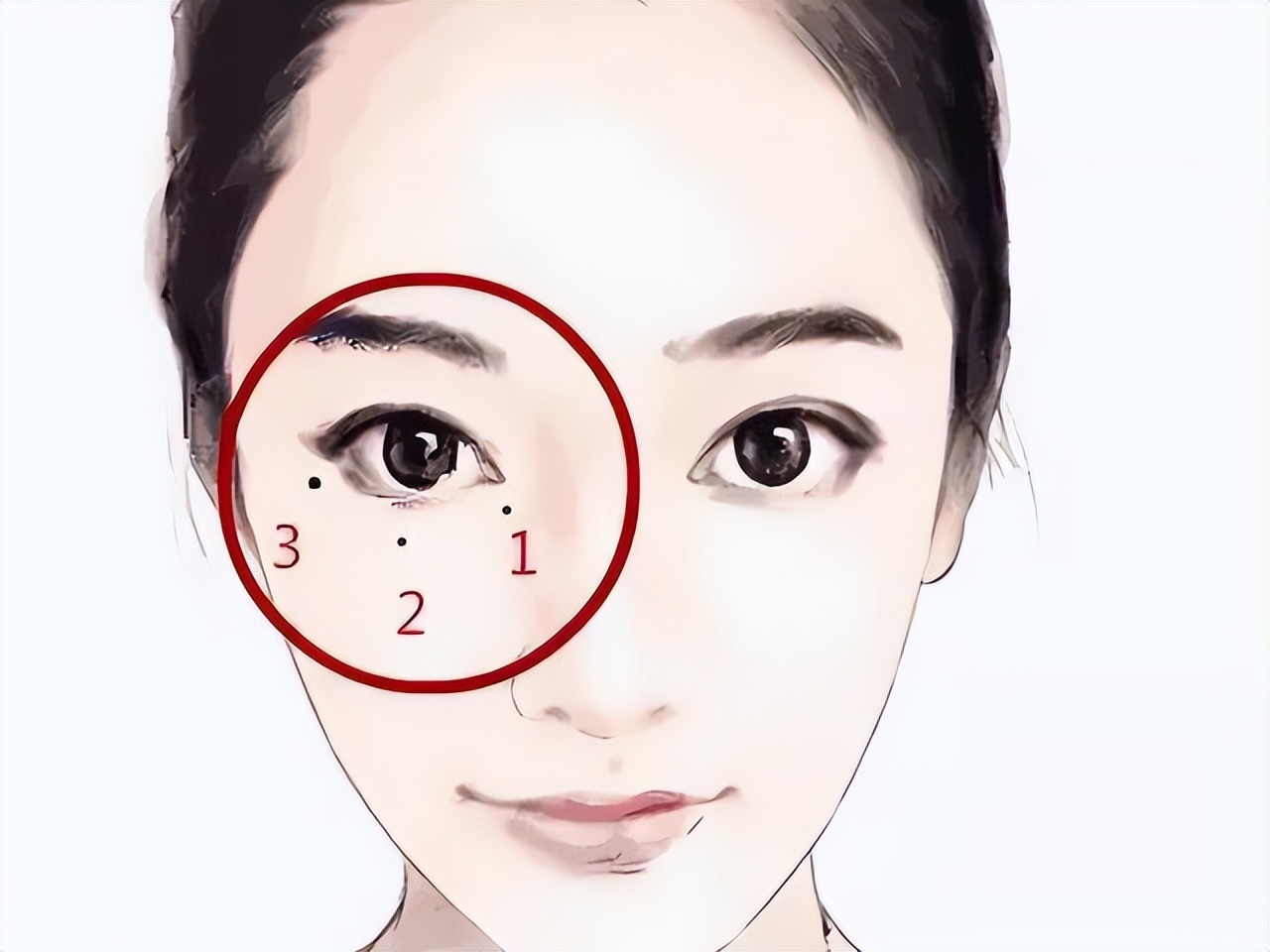 点痣不小心把痂弄掉会留坑吗,点痣的时候要不要把它扎烂