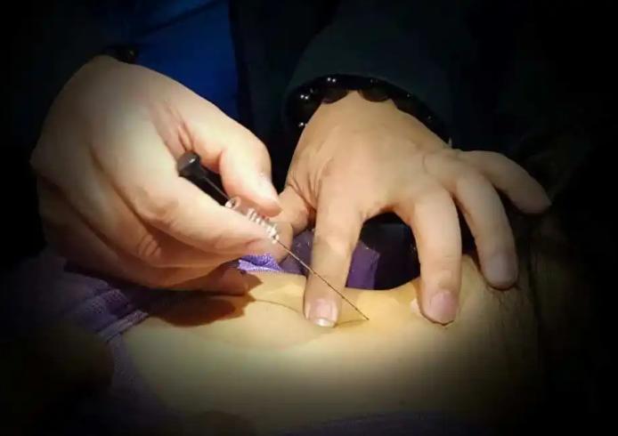 过敏性鼻炎哮喘综合征,过敏性鼻炎诱发哮喘的进程