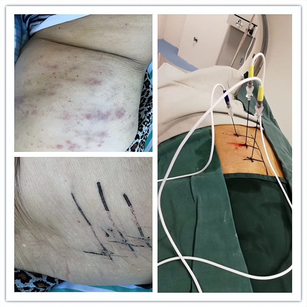 嘉善人民医院疼痛科专家,嘉善第一人民医院中医内科