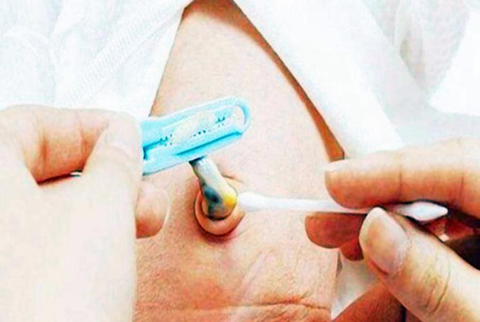 八个月宝宝肚脐眼黑泥怎么清理,宝宝肚脐眼黑黑的泥巴要清洗吗