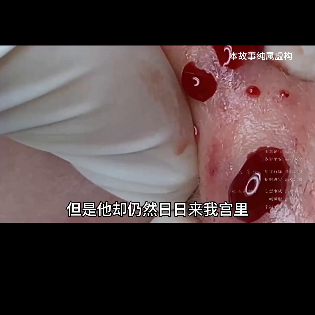 📖安安如招后续知乎#粉刺针的正确使用方法