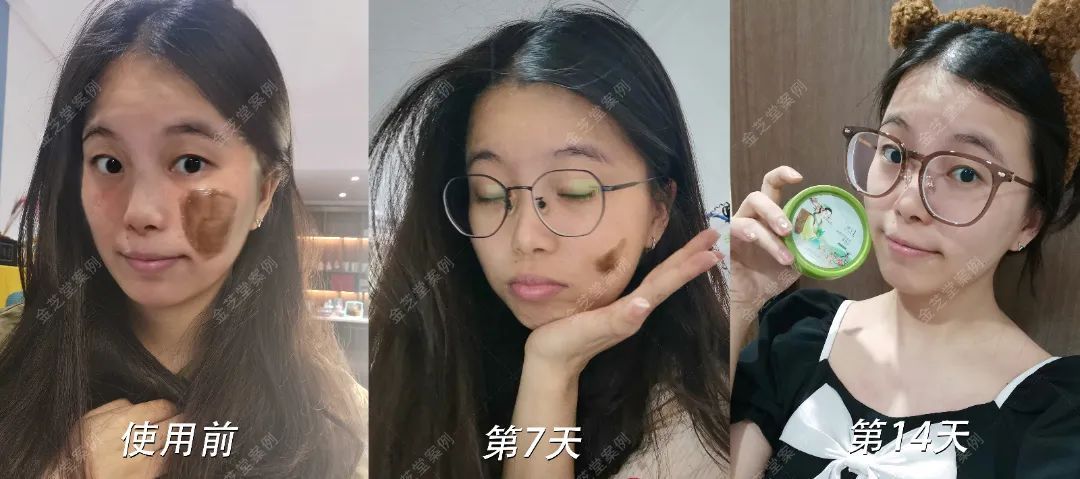 J子婷草本植萃焕颜面膜膏——每天躺着半小时就能变白变美