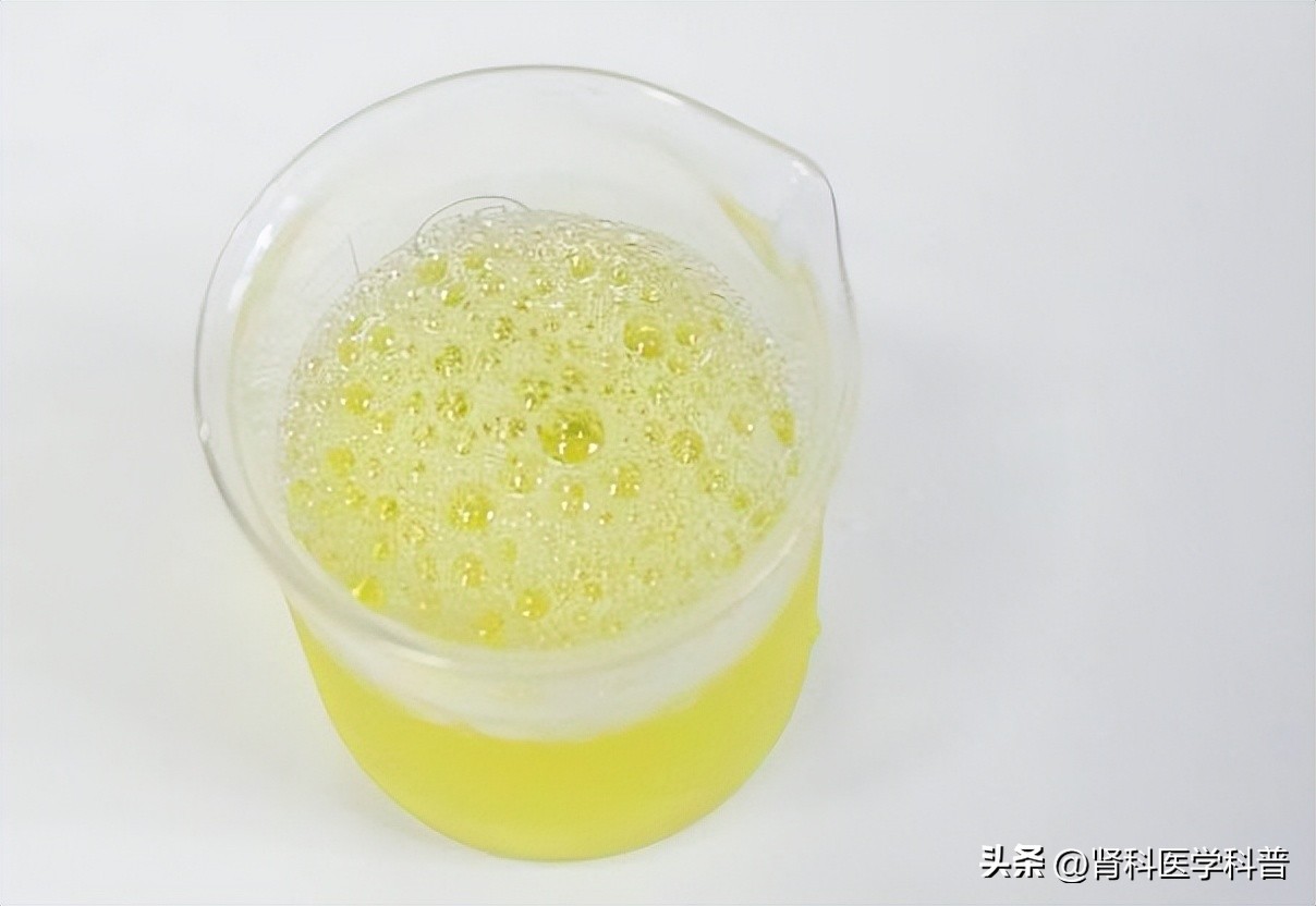 女性急性肾盂肾炎的症状有哪些,肾炎的早期症状女性脸色发黑吗